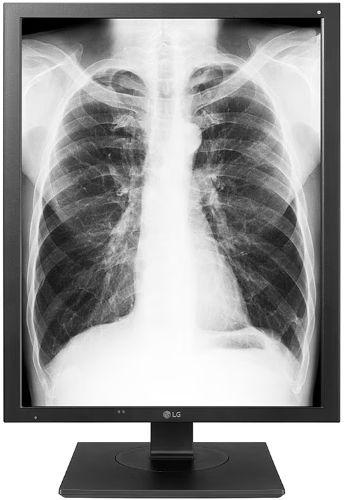 LG  21HK512D IPS Diagnostic Monitor - Black - Excellent